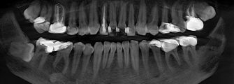 Your Guide To Tackling Troublesome Tooth Pain